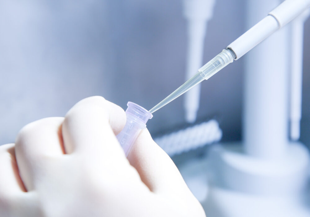 Does The U.S. Drug Test Immigrants?